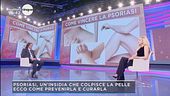 Come vincere la psoriasi