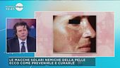 Le macchie della pelle