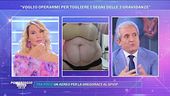 Rosaria: ''Voglio operarmi per togliere i segni delle 3 gravidanze''