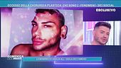 Eccessi della chirurgia plastica