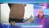 Ciacci sto per operarmi per perdere 40 kg