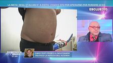 Ciacci sto per operarmi per perdere 40 kg