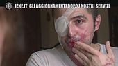 Aggiornamenti Iene.it: Giuseppe, sfregiato con l'acido: "Il Covid fa rimandare le operazioni"