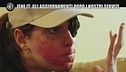 Aggiornamenti iene.it: Gessica Notaro, condannato in via definita l'ex che le ha tirato l'acido