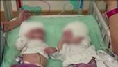 La nuova vita delle gemelline