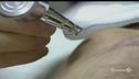 Botox vietato ai minorenni inglesi