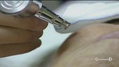 Botox vietato ai minorenni inglesi