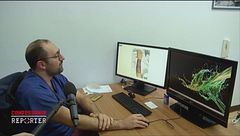 Una chirurgia molto complessa