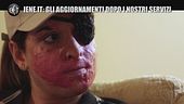 Gessica Notaro dopo le operazioni: "Il risultato è pazzesco"