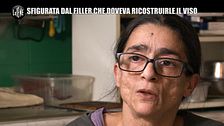 RUGGERI: Barbara, il suo volto rovinato e quel medico che non la risarcisce