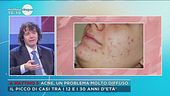 Acne, un problema molto diffuso