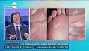Verruche, cosa sono e come combatterle