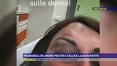 Francesca De Andrè pestata dall'ex: la nuova foto