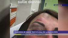 Francesca De Andrè pestata dall'ex: la nuova foto