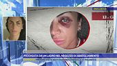 Picchiata da un ladro nel negozio di abbigliamento