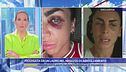 L'intervista a Francesca, aggredita da un ladro nel negozio di abbigliamento in cui lavora