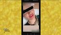 Russian Lips, il filler senza sicurezza
