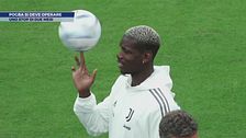 Pogba si deve operare: uno stop di due mesi