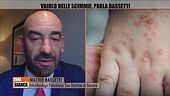 Vaiolo delle scimmie: parla Matteo Bassetti