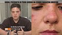 Giada, picchiata da cinque ragazzini omofobi