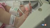 "Nessun allarme per epatite sconosciuta"