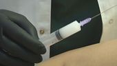 Silicone, illegale in Italia, ma non in Brasile