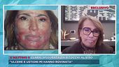 Clara, sfigurata da ritocchi al viso
