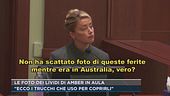 Le foto dei lividi di Amber in aula