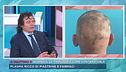Alopecia, le tipologie e come contrastarla