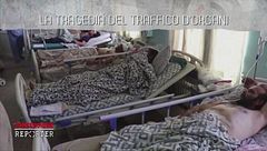 La tragedia del traffico d'organi