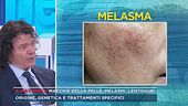 Macchie della pelle, melasmi, lentiggini
