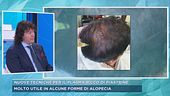 Nuove tecniche per il plasma ricco di piastrine
