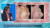 Mastoplastica additiva, i conigli del chirurgo plastico