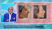 Rinoplastica, l'intervento al naso