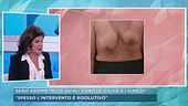 Seno asimmetrico, quali sono le cause e i rimedi?