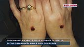 Trevignano, la verità sulle stigmate di Gisella