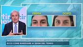 Invecchiamento del "terzo superiore"