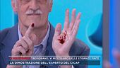 Trevignano, vi mostriamo delle stigmate finte
