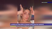 La moda di togliersi le rughe con il nastro adesivo