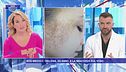 Sos medici - Helena, 20 anni, e la macchia sul viso
