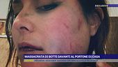 Roma, massacrata di botte davanti al portone di casa