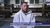 Emorragia cerebrale per il pugile Scardina: è in coma