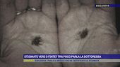 Stigmate vere o finte?