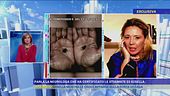 Parla la neurologa che ha certificato le stigmate di Gisella