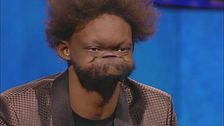 Jovante Carter: l'uomo dalla faccia snodata