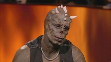 Diabao, l'uomo con più corna impiantate
