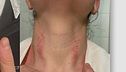 Quasi strangolata in guardia medica