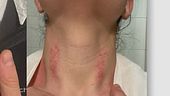 Quasi strangolata in guardia medica