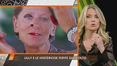 Liliana Resinovich e le misteriose ferite del volto