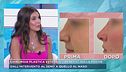 Chirurgia plastica estetica, i benefici della psiche